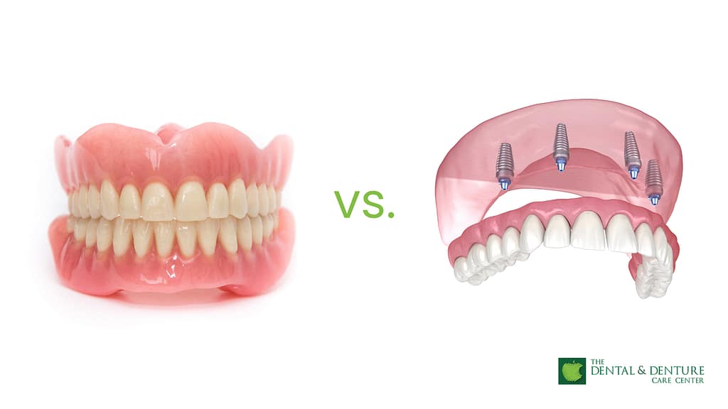 SnapIn Dentures vs. Regular Dentures The Dental & Denture Care Center