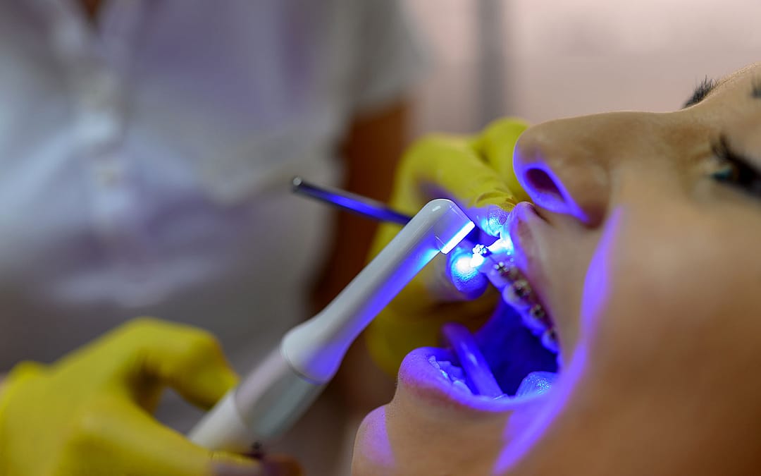 Dental Lasers The Dental And Denture Care Center Spring Hill, FL