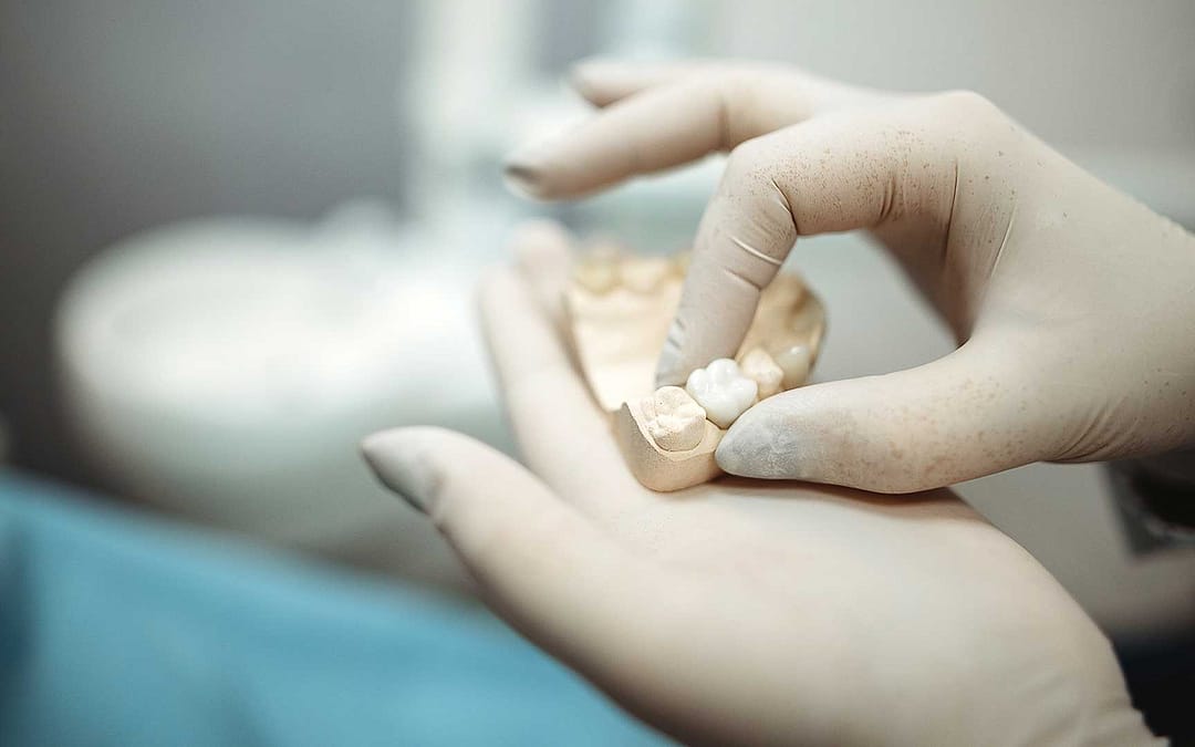 New Dental Crown Dental And Denture Care Center Spring Hill, Florida