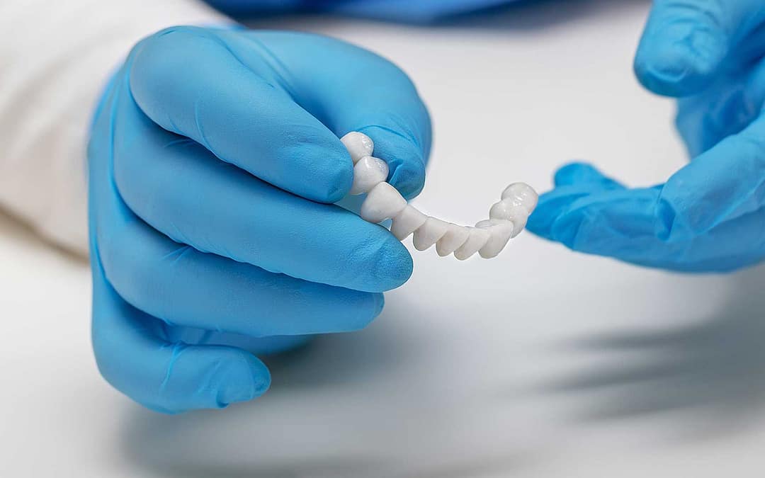 Dental Implants Archives The Dental & Denture Care Center