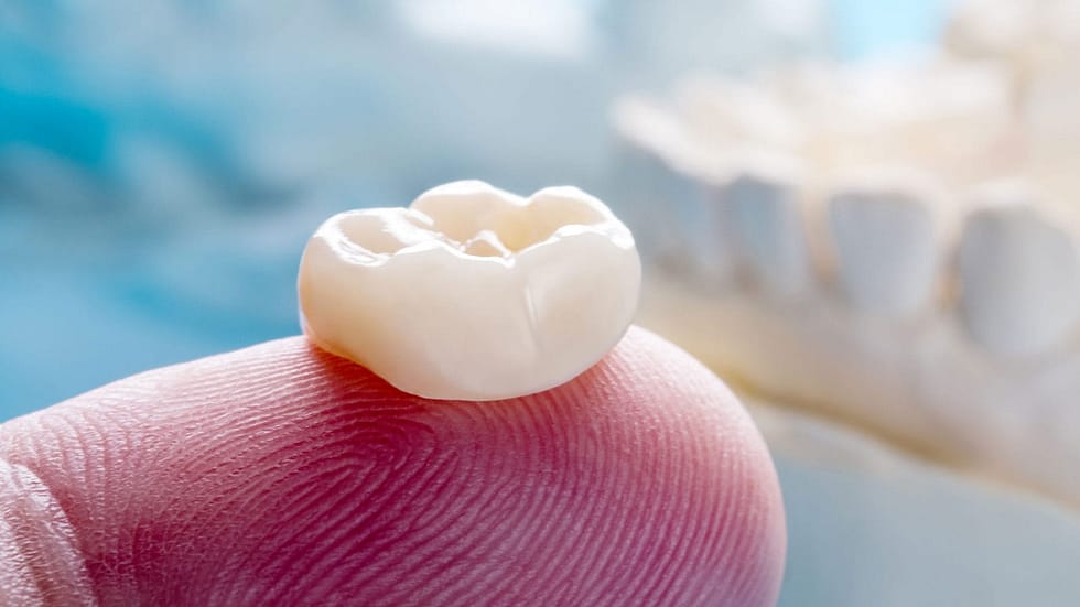 Dental Crowns Dental And Denture Care Center Spring Hill, Florida